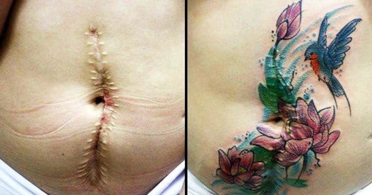A Brazilian Tattoo Artist Is Turning Scars Into Something Beautiful • Tattoodo